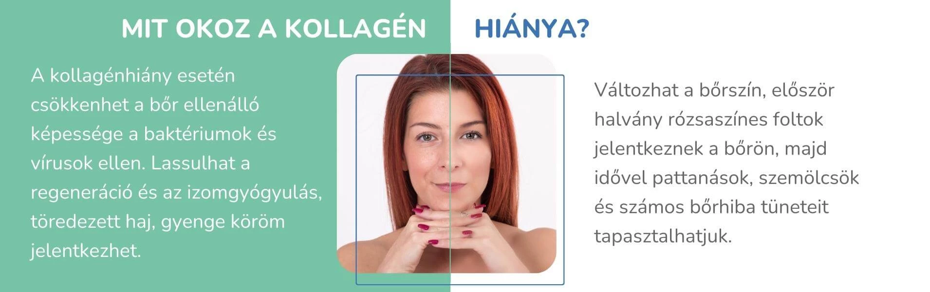 Mit okoz a kollagén hiánya?